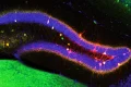 Scientists uncover how the brain adds new information to an existing memory